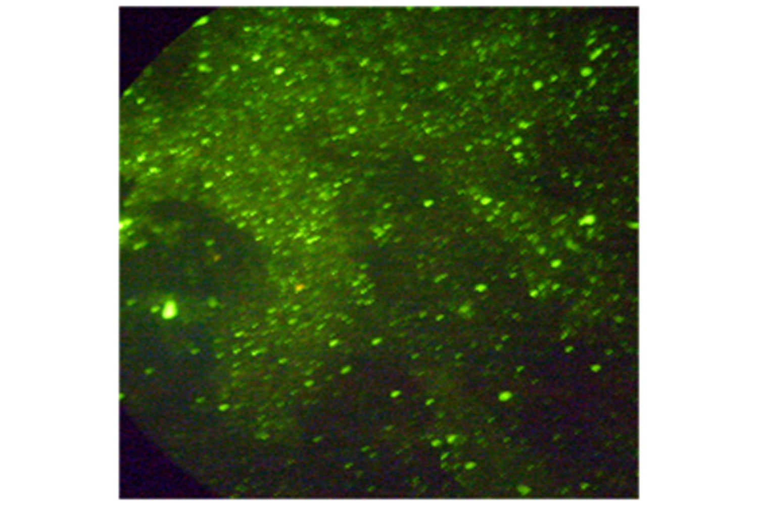 Diagnosis Of Animal Rabies By Immunofluorescence