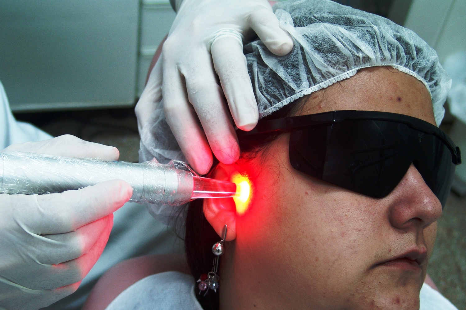 LED therapy on Temporo-Mandibular Disorder (TMD)