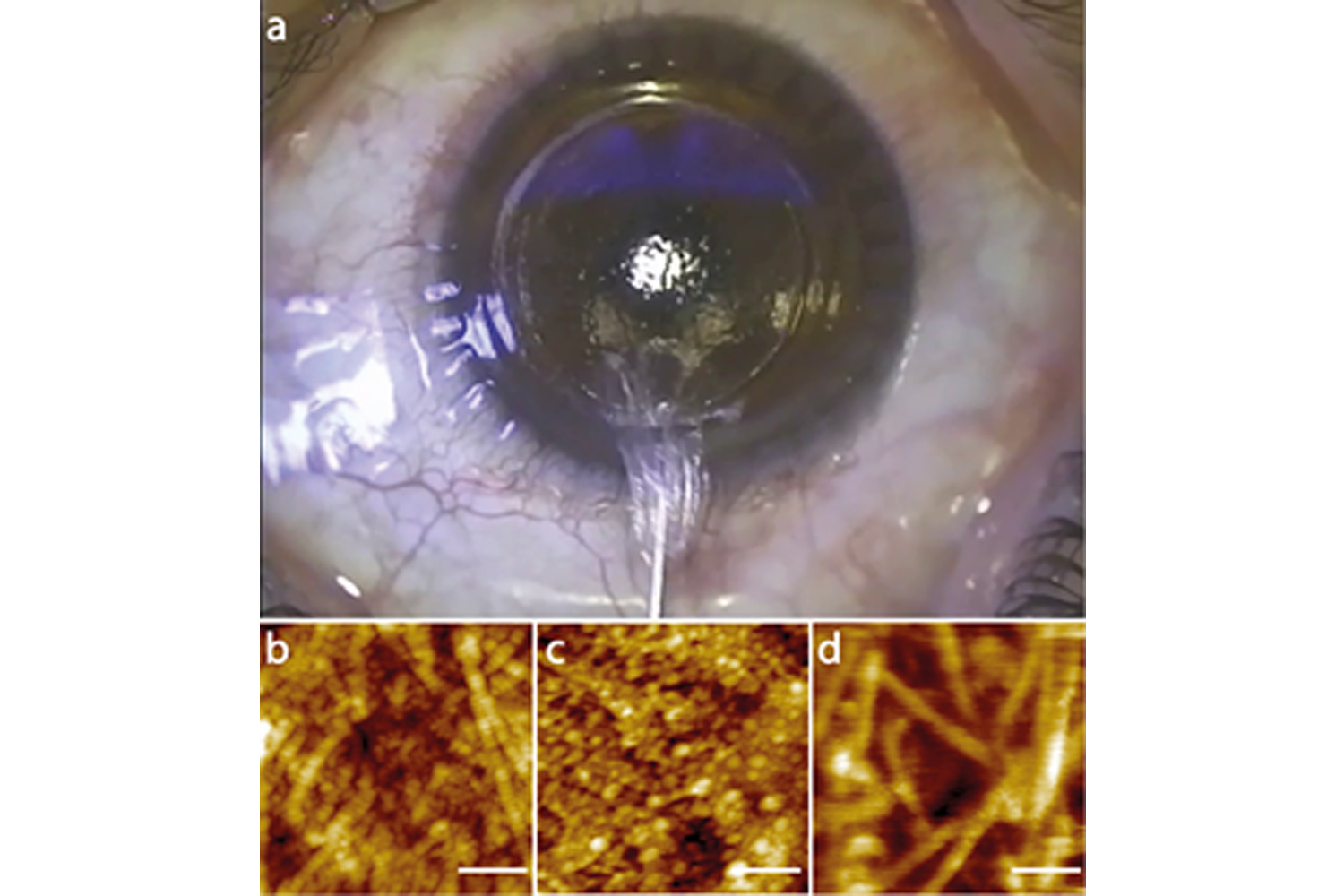 Corneal Stroma Revealed by Atomic Force Microscopy at Nanoscale