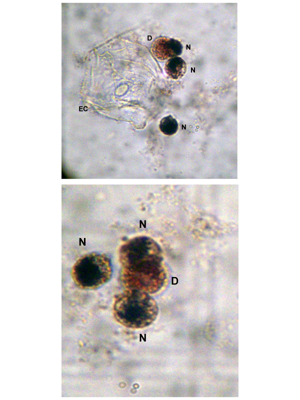 Benzidine Staining - Method to Detect Neutrophils in Whole Saliva of Patients with Renal Disease