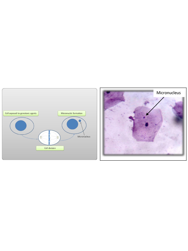 Micronucleus Test for Monitoring of DNA Damage to Oral Epithelial Cells