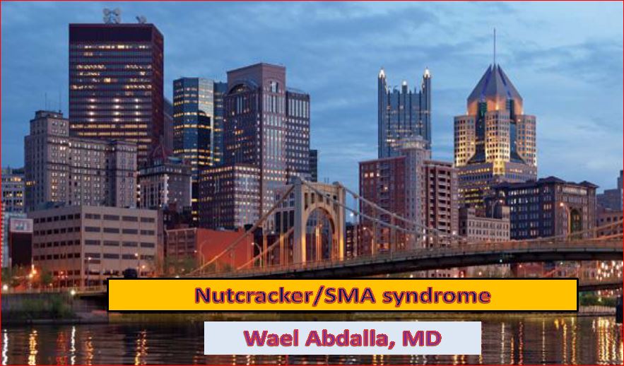 Nutcracker/SMA syndrome