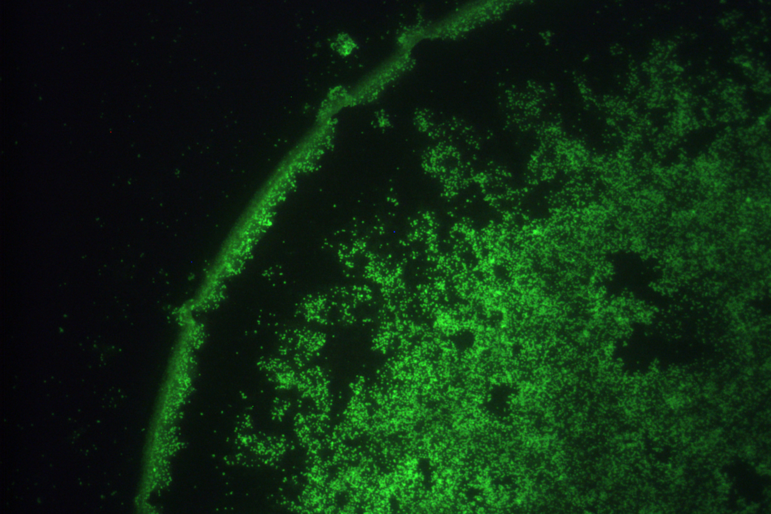 Chlamydophila pneumoniae by micro-immunoflurescence