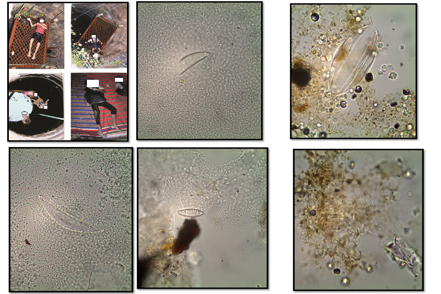 Diatom Test A Golden Standard Test In Drowning Cases