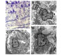 Ultra Structural Demonstration Of The Presence Of Dendritic Cells In Atherosclerotic Lesions Of The Aorta Of Rabbits With Experimental Hypercholesterolemia