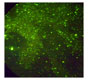 Diagnosis Of Animal Rabies By Immunofluorescence