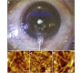 Corneal Stroma Revealed by Atomic Force Microscopy at Nanoscale