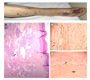 Kaposi’s sarcoma in a frail elderly