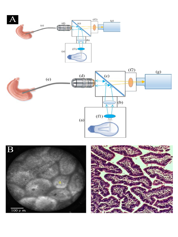 Fiber Optic Endomicroscopy Enables In Situ Microscopic 