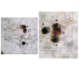 Benzidine Staining - Method to Detect Neutrophils in Whole Saliva of Patients with Renal Disease