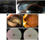 Ascaris lumbricoides - From Bedside to Benchside