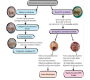 Stepwise Excavation A conservative Community-Based Dental Treatment of Deep caries To Preserves the Tooth Vitality