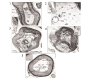 Nerve Regeneration and Magnetic Resonance Energies