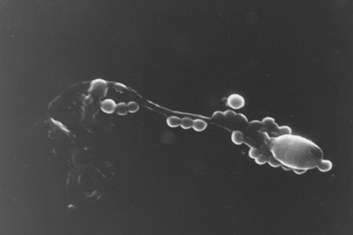 Scanning Electron Micrograph showing Adherence of Staphylococcus Aureus to Human Sperm