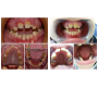 Amelogenesis Imperfecta: A Developmental Dental Anomaly