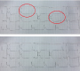 A New ECG Sign