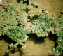 Biofilms as a Source of Pathogenicity