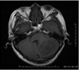 Axial Section of Cone Beam Computed Tomographic Analysis of Root Canal