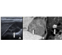 An Unusual Right Upper Quadrant Pain Cause: Multiseptate Gallbladder