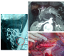 A Superior Mesenteric Artery Mycotic Aneurysm Caused by Streptococcus equi Treated Surgically