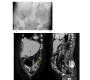 Abdominal Trompe-Loeil Spirals