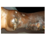 Mycetoma of the Upper Extremity: A Case Report