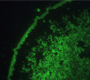 Chlamydophila pneumoniae by micro-immunoflurescence