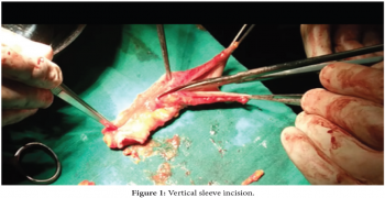 Can we avoid a protective stoma and improve functional results after surgery for rectal cancer? Reinforced and delayed colo-anal anastomosis: A new technique Observational study about 5 cases