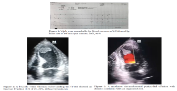 LV Clot in Post PCI Post VT Ablated Patient with Severe LV Systolic Dysfunction